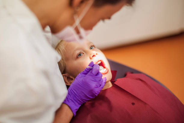 Best Knocked-Out Tooth (Avulsed Tooth) Treatment in Union City, CA
